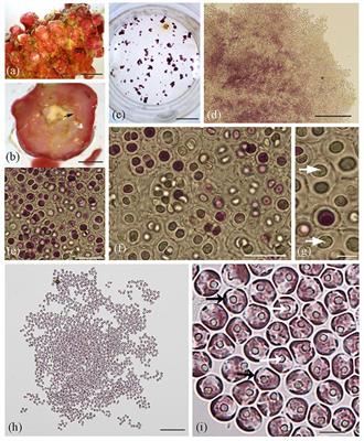 First Report of Endolithic Members of Rhodosorus marinus (Stylonematales, Rhodophyta) Growing Inside Rhodoliths Offshore Louisiana, Northwestern Gulf of Mexico